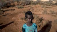 At least 200 children have died in Somalia since January from drought-caused malnutrition: UN